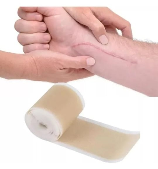 Cinta de Silicona Médica para Cicatrices 4 cm x 100 cm